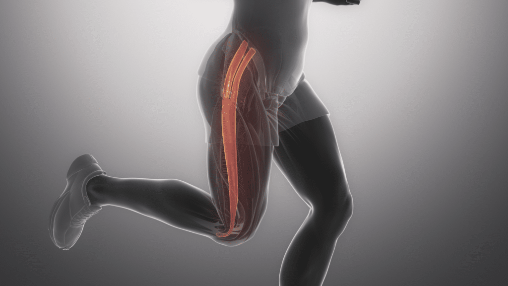 Diagrama of fascia in an animated runner