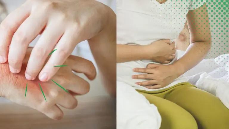 A side by side comparison showing a link between eczema and gut health.