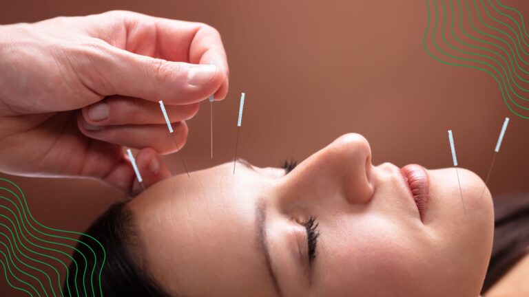 A woman receiving facial acupuncture